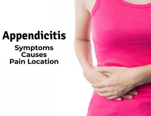 Appendicitis: Early Symptoms, Causes and Pain Location