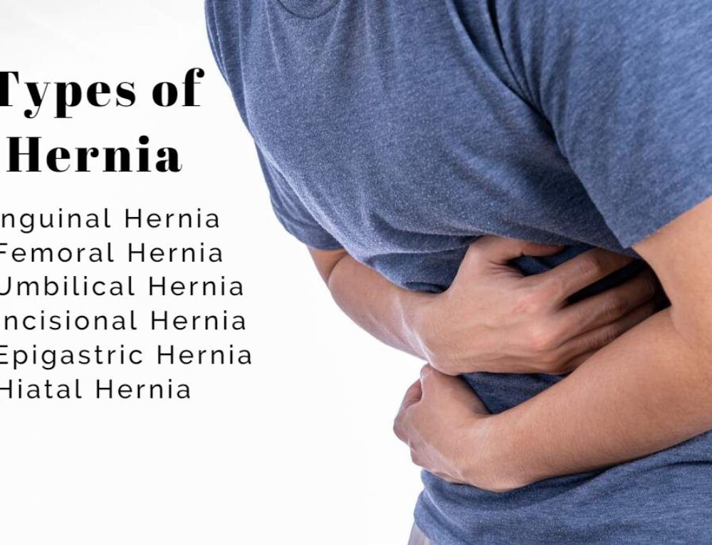 Umbilical Hernia Symptoms and Causes Dr. Abhijit Gotkhinde