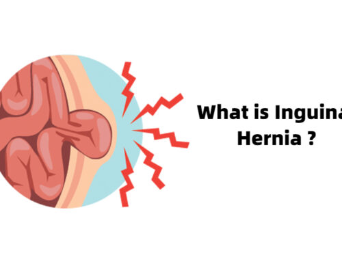 What is an Inguinal Hernia?