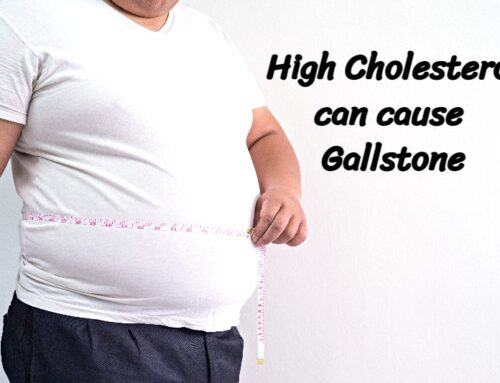 The Link Between High Cholesterol and Gallstones