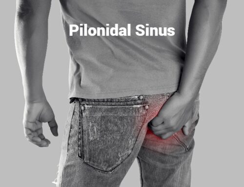 Pilonidal Sinus Infection And Surgical Treatment