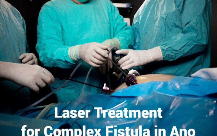 Best Complex Fistula in Ano- Laser Treatment in Pune