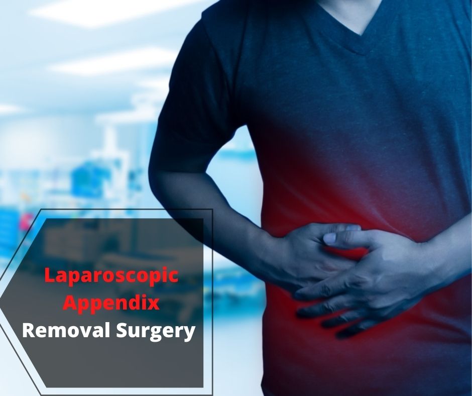 Laparoscopic Appendix Removal Surgery in pune1