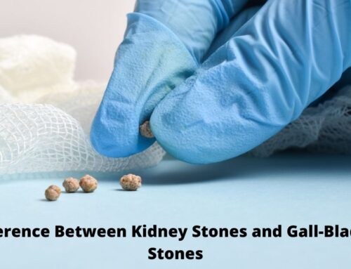 Difference Between Kidney Stones and Gall-Bladder Stones
