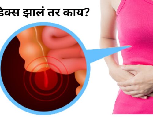 अपेंडिक्स झालं तर काय(What If Appendicitis Occurs In Marathi)?