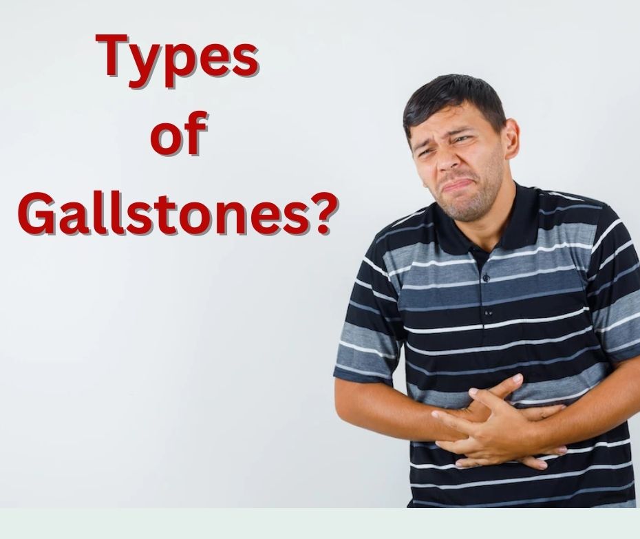 What are the 3 types of Gallstones?