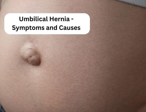 Umbilical Hernia- Symptoms and Causes