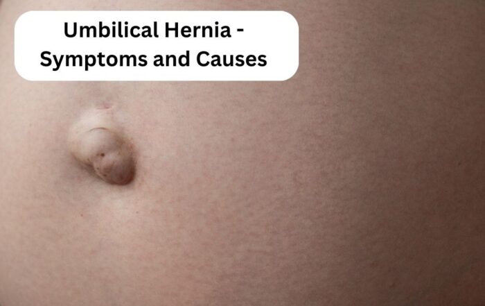 Umbilical Hernia- Symptoms and Causes | Dr. Abhijit Gotkhinde