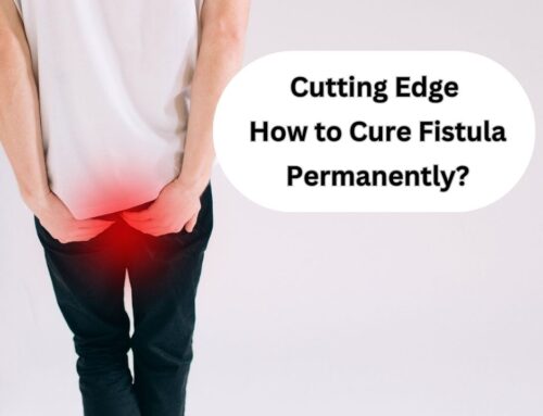 Cutting Edge | How to Cure Fistula Permanently?