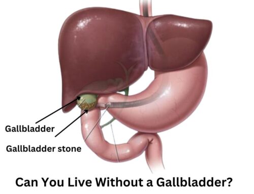 Can You Live Without a Gallbladder?