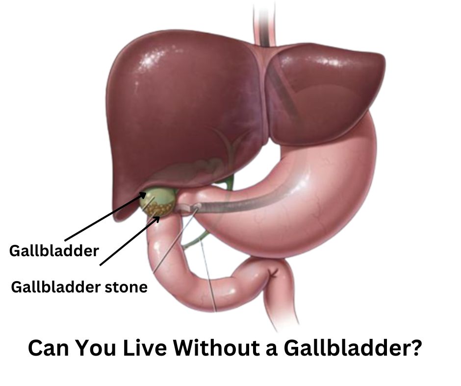 Can You Live Without a Gallbladder? | Dr. Abhijit Gotkhinde