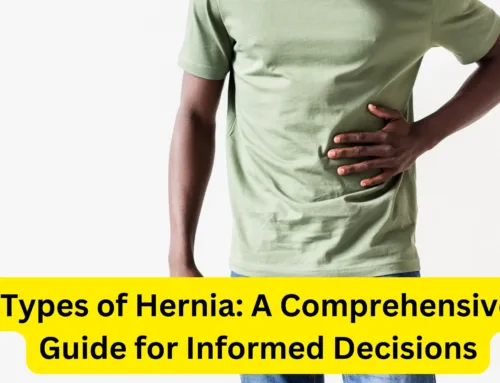 Types of Hernia: A Comprehensive Guide for Informed Decisions