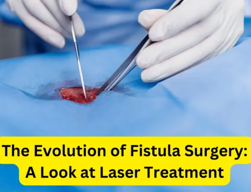 The Evolution of Fistula Surgery: A Look at Laser Treatment