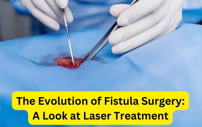 Fistula Surgery