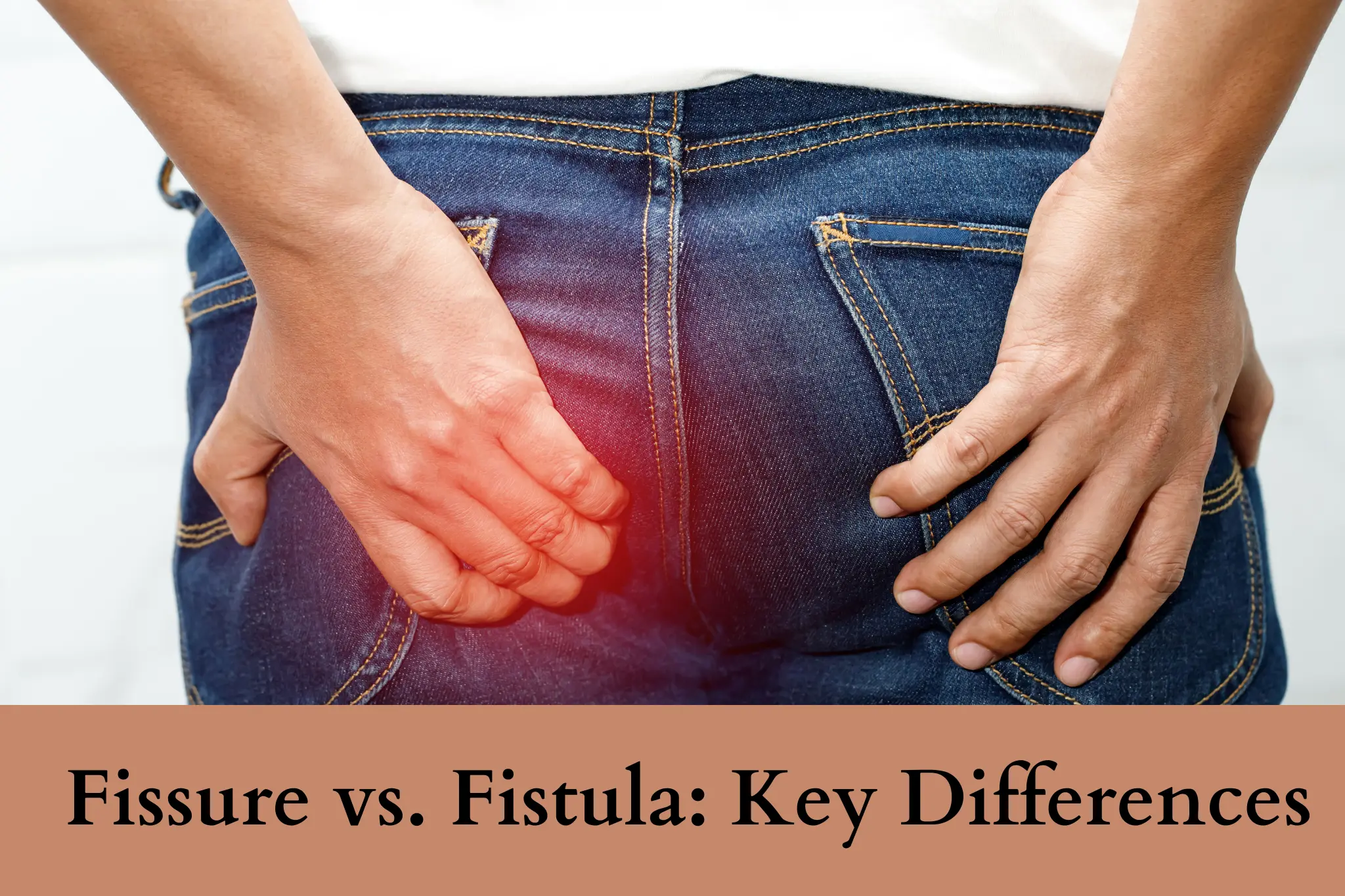 Fissure vs. Fistula